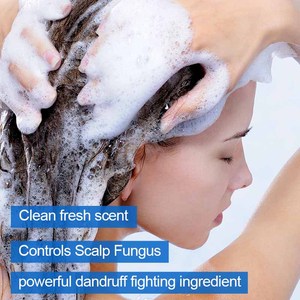 Champú OEM Suave <span class=keywords><strong>para</strong></span> <span class=keywords><strong>el</strong></span> Cabello, Controla <span class=keywords><strong>el</strong></span> Hongos del Cuero Cabelludo, Ingrediente Potente Contra <span class=keywords><strong>la</strong></span> Caspa, Aroma Fresco y Limpio - Product Image 2