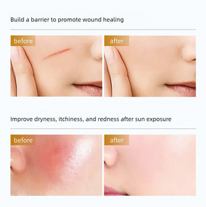 Medizinisches rekombinantes Kollagen-Wund <span class=keywords><strong>spray</strong></span> Hautreparatur-Heils pray für postoperative Laser chirurgie und Fruchtsäure-Peeling - Product Image 4