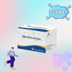 공장 판매 HBc 항체 항-HB 표면항원 ELISA 검사 키트 (인체용, 96회 테스트) - Product Image 4