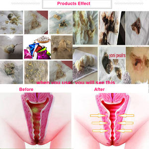 Yoni-perlas <span class=keywords><strong>de</strong></span> desintoxicación, venta al por mayor con Etiqueta Privada, embalaje personalizado - Product Image 5