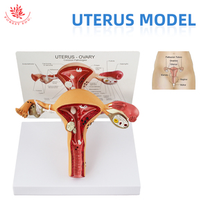 Modello utero organi riproduttivi femminili anatomia struttura patologica educazione anatomica - Product Image 2