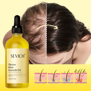 Huile essentielle de soins capillaires ordinaires nourrissante et réparatrice à l'extrait de romarin biologique avec étiquette personnalisée - Product Image 2