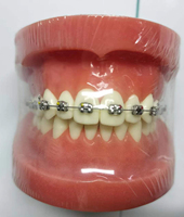 Estándar médico ortodoncia estudio dentista anatómico dental tipodont modelos dientes modelo