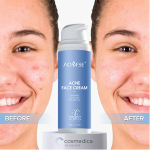 Crema para el acné más vendida, ingrediente de hierbas orgánicas, crema para espinillas de <span class=keywords><strong>piel</strong></span> suave e iluminadora para <span class=keywords><strong>piel</strong></span> grasa - Product Image 1