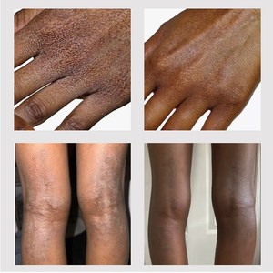 Crème <span class=keywords><strong>miracle</strong></span> à l'huile de cheval, puissance dorée, crème anti-gel <span class=keywords><strong>pour</strong></span> <span class=keywords><strong>les</strong></span> pieds et <span class=keywords><strong>les</strong></span> <span class=keywords><strong>mains</strong></span>, nutriments, crème éclaircissante à l'huile de cheval - Product Image 6