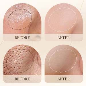 Mousse nettoyante anti-acné biologique, soin hydratant des pores, soin de la peau, nettoyant visage à l'<span class=keywords><strong>arbre</strong></span> à thé et à l'aloe vera, nettoyant moussant pour le visage, brosse - Product Image 6