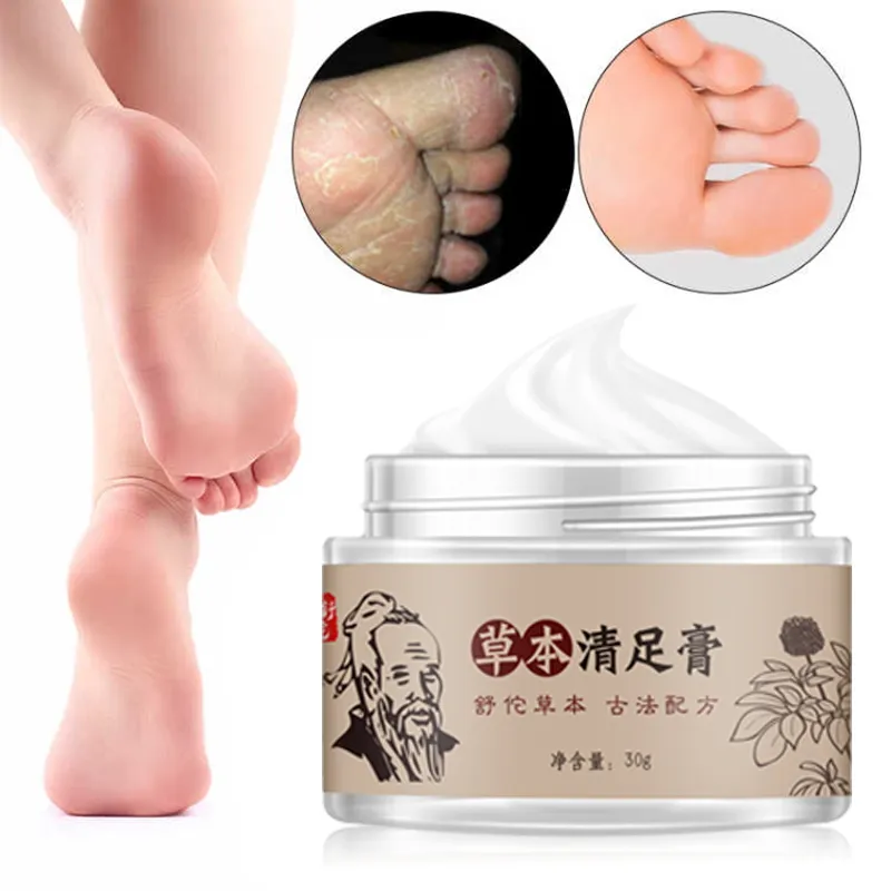 OBM OEM/ODM krim kaki tangan Herbal 30g krim kaki retak anti-kering krim perbaikan tumit retak produk perawatan kaki wanita dewasa