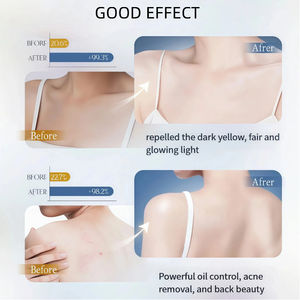 Promotion Benutzer definierte Hyaluron säure Körper lotion Ätherisches Öl Aufhellung formel - Product Image 3