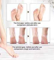 Lime électrique pour les callosités, grattoir pour les pieds, outils de pédicure, râpe pour les pieds, éliminateur de peaux mortes, outil de soin des pieds