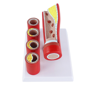 Modello di arteria coronaria cardiovascolare a strati trasparenti con marcatori patologici - Product Image 4
