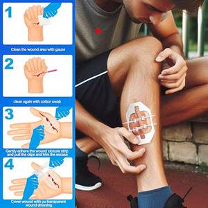 Kesim bakım cihazı için sütür olmadan yara kapatma şeritleri yapışkan bandajlar cerrahi dikiş şeritleri kiti - Product Image 2
