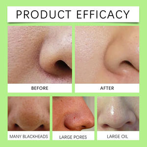 Point noir enlever masque Peel bandelettes nasales nettoyage en profondeur rétrécissement pores nez tête noire enlever autocollants peau masque Patch 24 pièces - Product Image 2