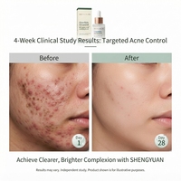 Sérum clarifiant à l'acide azélaïque fermenté à 10 % avec 2 % de niacinamide et de Centella Asiatica