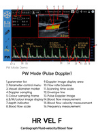Sonde échographique vétérinaire Doppler couleur portable ECI-X6C Type-C, sonde rectale, machine d'échographie pour la gestation des animaux d'élevage