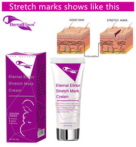 تمتد علامة كريم البشرة كريم تبييض البشرة الداكنة ، إزالة الندوب كريم العناية ببشرة الحمل إصلاح كريم - Product Image 6