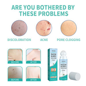 Private Label Roll-On Voor Mannen Oplossing-Na Shave Reparatie Spot <span class=keywords><strong>Corrector</strong></span> Na Scheercrème - Product Image 6