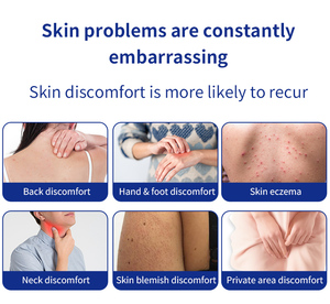 Crème pour l'eczéma à marque privée OEM, éclaircissante, à base de plantes, antifongique, apaisante en profondeur, pour le corps, nouvelle formule chinoise, meilleure crème anti-démangeaisons, CE - Product Image 6