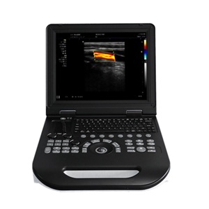 Kustomisasi jantung OB GYN mesin ecocardiografi Laptop pemindai Ultrasound portabel Ecografo Portatil - Product Image 4