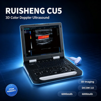 Échographe Doppler Couleur 3D Portable RUISHENG CU5 avec DICOM 3.0 et Batterie 6000 mAh