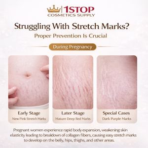 <span class=keywords><strong>Crème</strong></span> <span class=keywords><strong>anti</strong></span>-vergetures à la <span class=keywords><strong>vitamine</strong></span> E, sûre et efficace pour éliminer les vergetures post-partum, <span class=keywords><strong>crème</strong></span> <span class=keywords><strong>anti</strong></span>-vergetures cosmétique, directement de l'usine - Product Image 2