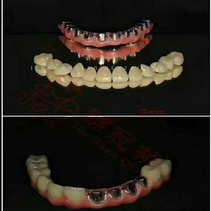Implan gigi kustom Titanium <span class=keywords><strong>Abutment</strong></span> dengan Screwed Zirconia mahkota untuk latihan gigi En China <span class=keywords><strong>Dental</strong></span> Lab - Product Image 2