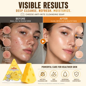 Produits de bain en marque privée, nettoyage en profondeur et exfoliation, savon artisanal anti-acariens pour le visage, traitement de l'acné - Product Image 2