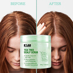 <span class=keywords><strong>Exfoliante</strong></span> para el Cuero Cabelludo de Marca Privada, Champú <span class=keywords><strong>Exfoliante</strong></span> para Cuero Cabelludo Seco y con Picazón, Champú Clarificante para Desintoxicar el Cuero Cabelludo - Product Image 6