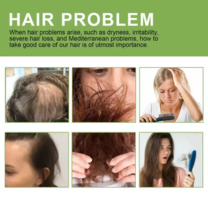 Olio per la Cura dei Capelli 100% <span class=keywords><strong>Naturale</strong></span> a Marchio Privato, Siero per il Trattamento del Cuoio Capelluto, Olio Organico per la Ricrescita dei Capelli 60ml - Product Image 6