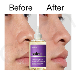 Oalen Private Label Facial Exfoliating Toner Daily Brightening Treatment Reduces Uneven <strong>Marks</strong> for Nice Skin Tone - Product Image 3