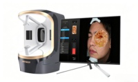 Appareil de scanner facial DX pour la détection et l'analyse des problèmes cutanés potentiels tels que l'acné, utilisé pour le diagnostic facial