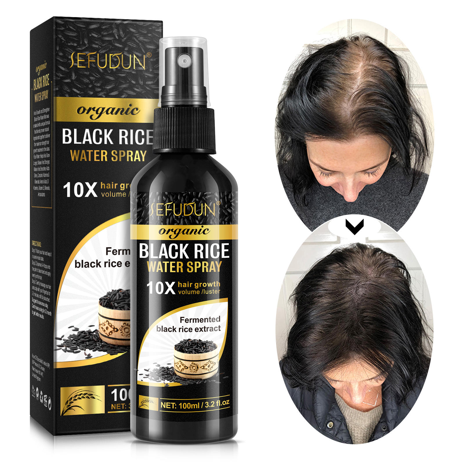 Spray para el crecimiento del cabello 100ml