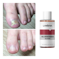 LANBENA Traitement Efficace des Ongles, Solution Réparatrice Anti-fongique