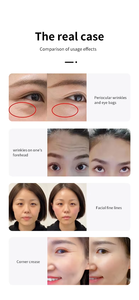 Multi-Functional Anti-Aging Body <b>Massage</b> Pore Shrinking <b>Machine</b> Personal Care Beauty Device - Product Image 4