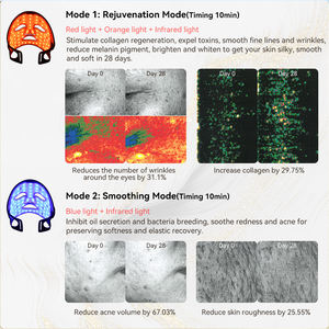 <span class=keywords><strong>Masque</strong></span> de <span class=keywords><strong>luminothérapie</strong></span> pour le visage à LED infrarouge <span class=keywords><strong>anti</strong></span>-<span class=keywords><strong>rides</strong></span> à usage domestique 830nm 630nm - Product Image 4
