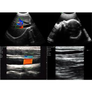 Échographe vétérinaire portable sans fil couleur Doppler B26 à usage général avec sondes convexe, linéaire et cardiaque 192 éléments - Product Image 6