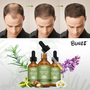 Aceite de Romero para el cabello para hombres y mujeres, tratamiento de biotina para la pérdida de cabello, Aceites orgánicos para el crecimiento salvaje, Etiqueta Privada, venta al por mayor