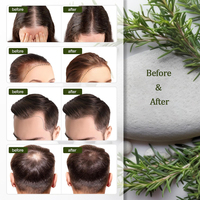 100% Pure Rosemary Hair Oil Kit Huile de croissance pour soins capillaires avec Derma Roller Idéal pour les cheveux secs et abîmés Convient aux hommes et aux femmes