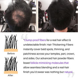 Polvo Estilizador de Fibra Capilar para la Pérdida de Cabello, Optimizador Instantáneo de Línea Capilar, Densificador del Crecimiento del Cabello - Product Image 3