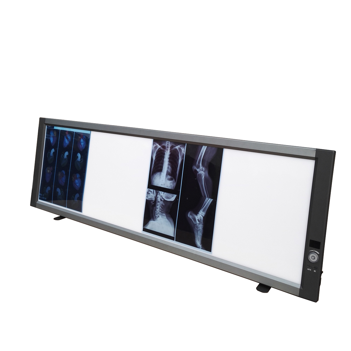 Visor de películas de rayos X LED médico ajustable Cuádruple visión de caja de visualización de películas de rayos X