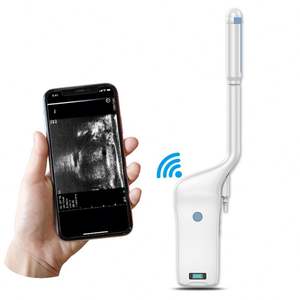 Precio de fábrica 128 elementos 3 en 1 biplano inalámbrico Color Doppler ultrasonido microconvexo Sonda de matriz lineal para Urología - Product Image 1