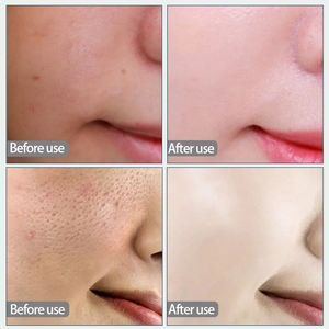 Masque au collagène OEM pour réduire les poches et les ridules, atténuer les cernes, soulager les peaux rugueuses, masque facial en cristal de collagène pour le visage - Product Image 6