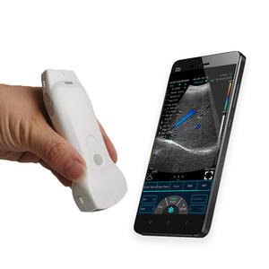Sonde sans fil à ultrasons de haute qualité multifonctionnel sans fil <span class=keywords><strong>Mini</strong></span> détection d'ultrasons Doppler couleur pour l'abdomen/vasculaire - Product Image 1