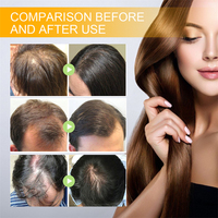 Eelhoe 30ml Serum Penumbuh Rambut Biotin Anti Rontok, Menghaluskan, Menutrisi Akar, Menyegarkan Folikel Rambut, Spray Penguat