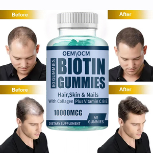 Gomitas de Biotina y Multivitaminas para el Crecimiento del Cabello, Salud de la Piel y Salud de las Uñas, para Adolescentes y Adultos, Certificación Halal, OEM - Product Image 3