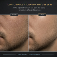 Crema Facial Hidratante para Hombre Lance Private Label, Ácido Hialurónico, Urea, Glicerina, Hidratante Facial para Todo Tipo de Piel, Cuidado Facial