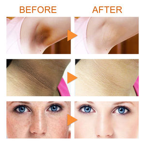 สเปรย์บำรุงเหงือก EELHOE ป้องกันและซ่อมแซมเหงือก ลดกลิ่นปาก ลดการบวมและอักเสบของเหงือก บรรเทาอาการปวด ดูแลสุขภาพช่องปาก - Product Image 2