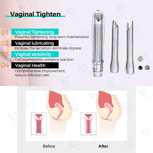 Láser Fraccional de CO2 Portátil, Modo 4D, Rejuvenecimiento de <span class=keywords><strong>la</strong></span> Piel, Tratamiento Vaginal, Máquina de Rejuvenecimiento Cutáneo con Láser Fraccional de CO2 - Product Image 4