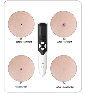 Stylo électrique <span class=keywords><strong>professionnel</strong></span> tendance pour l'élimination des taches cutanées, verrues et tatouages – Le best-seller pour une peau éclatante - Product Image 2