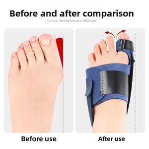 Séparateur d'orteils réglable pour hallux valgus, correcteur de bunion, attelle orthopédique de nuit avec support en alliage d'aluminium intégré - Product Image 3
