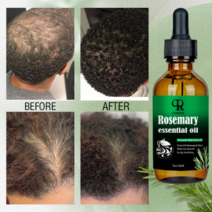 Huile de Romarin Croissance Capillaire et Huile de Ricin Renforçante Rapide, Formule Biologique OEM 50ml pour Tous Types de Cheveux - Product Image 4